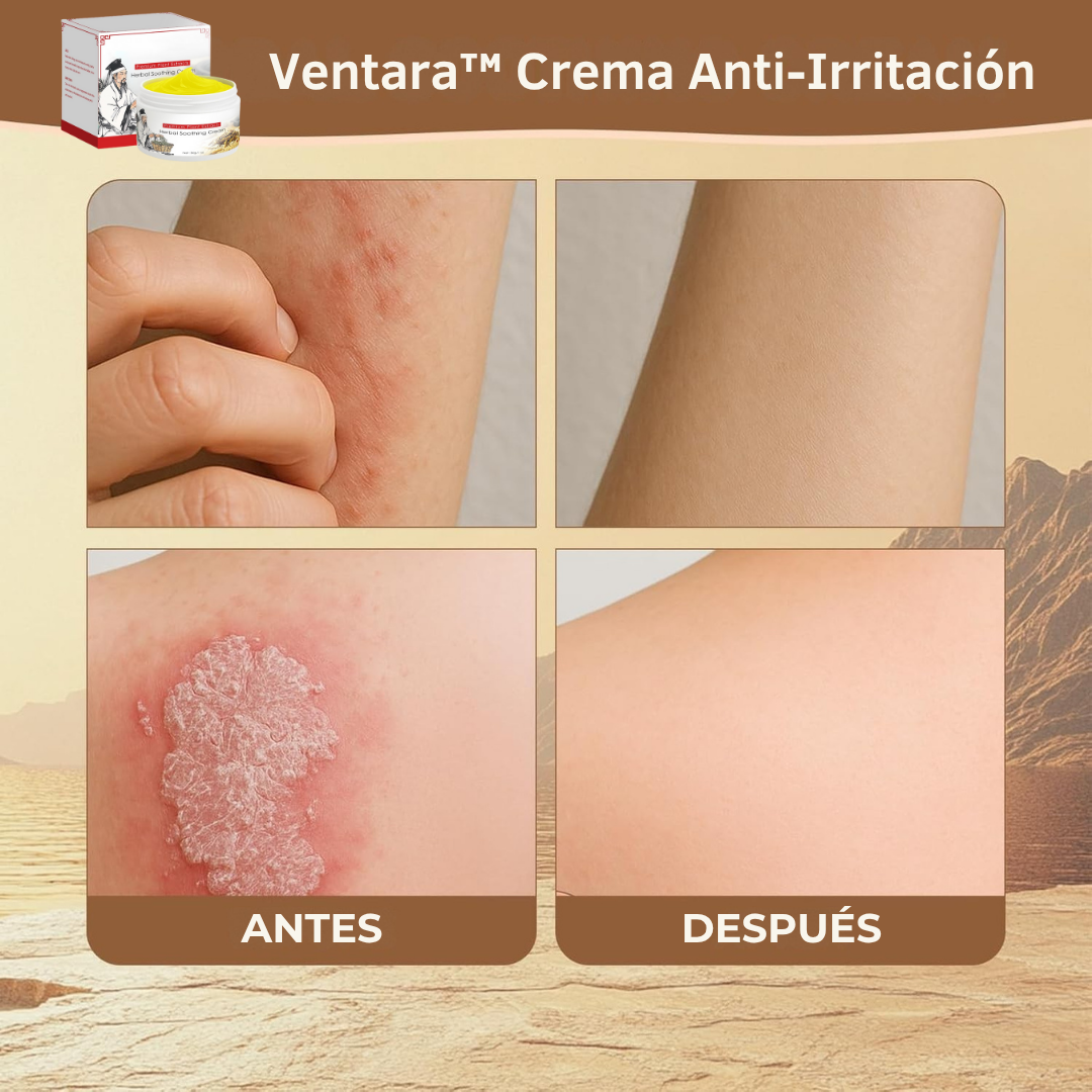 Ventara™ Crema Anti-Irritación